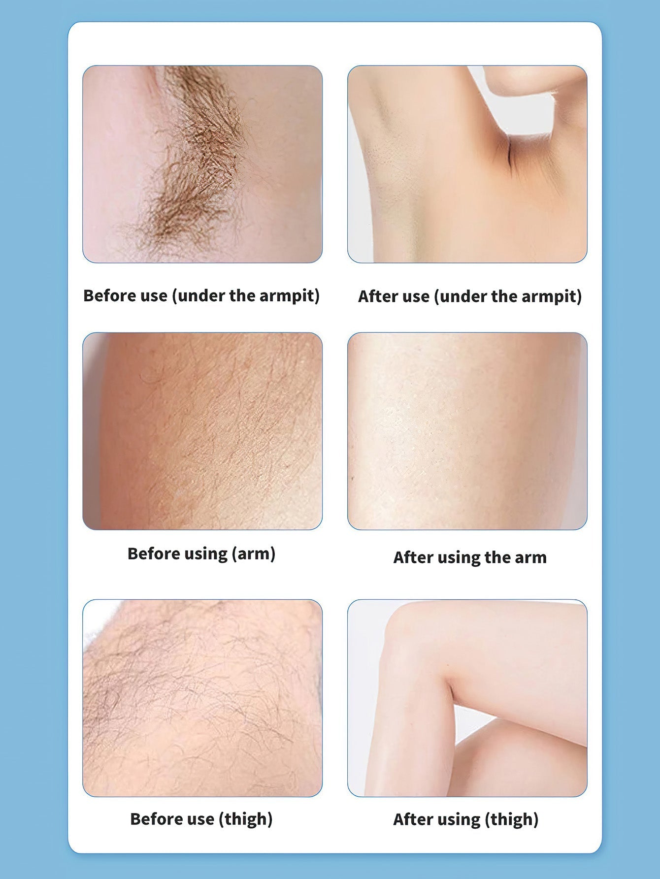 Multifunctional Hair Removal Shaver ¨C Portable and Versatile Grooming Tool - 3 Colors