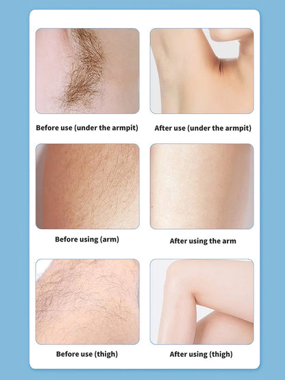 Multifunctional Hair Removal Shaver ¨C Portable and Versatile Grooming Tool - 3 Colors