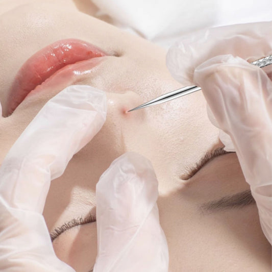 Cell Clip Acne Needle Set